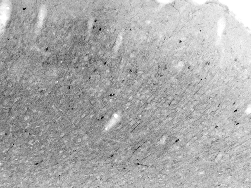 Adult rat visual cortex (note interneurons) immunohistochemistry.