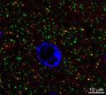 Array tomography immunofluorescence of an LRWhite-embedded 70 nm section from adult mouse cortex layer 2/3 with L113/130 (green), rabbit mAb PSD-95 (Cell Signaling 3450, red) and DAPI (blue), where L113/130 colocalizes with many PSD-95 puncta. Image courtesy of Kristina Micheva (Stanford).