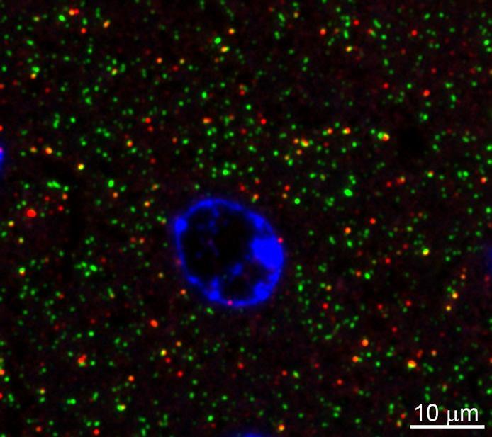 Array tomography immunofluorescence of an LRWhite-embedded 70 nm section from adult mouse cortex layer 2/3 with L113/130 (green), rabbit mAb PSD-95 (Cell Signaling 3450, red) and DAPI (blue), where L113/130 colocalizes with many PSD-95 puncta. Image courtesy of Kristina Micheva (Stanford).