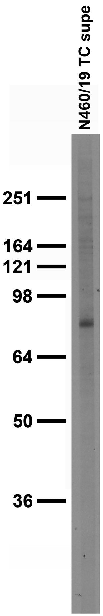 Adult rat brain membrane immunoblot