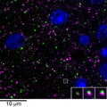 array tomography immunofluorescence of an LRWhite-embedded 70 nm section from adult mouse cortex with L106/4 (green), rabbit mAb GAD2 (Cell Signaling 5843, magenta) and DAPI (blue). The insert shows three consecutive sections through the synapse that is marked with a white box. Image courtesy of Kristina Micheva (Stanford).