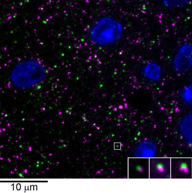 array tomography immunofluorescence of an LRWhite-embedded 70 nm section from adult mouse cortex with L106/4 (green), rabbit mAb GAD2 (Cell Signaling 5843, magenta) and DAPI (blue). The insert shows three consecutive sections through the synapse that is marked with a white box. Image courtesy of Kristina Micheva (Stanford).