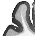 Adult rat cerebellum immunohistochemistry.