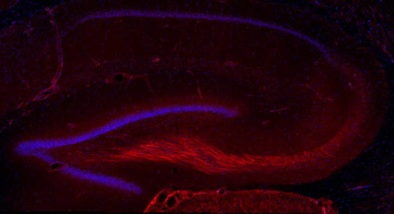 Immunofluorescence labeling of adult rat hippocampus with N450/53 TC supe (red) and Hoechst nuclear stain (blue).