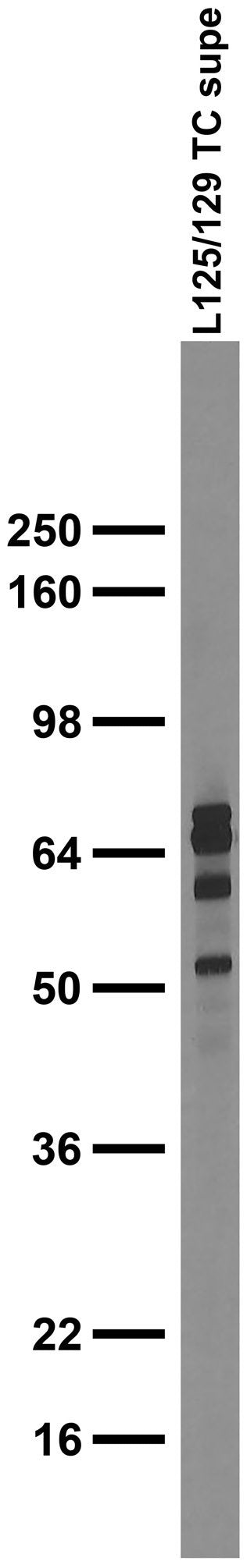 Adult rat brain membrane immunoblot.