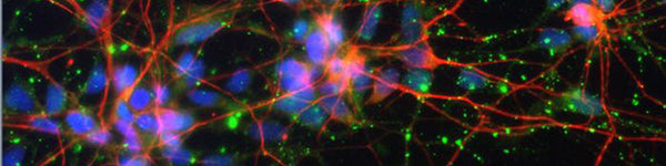 A Unique Immunogen is Crucial when Designing Highly-Specific Antibodies