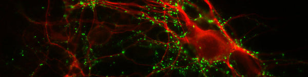 Why Don’t More Researchers Validate Antibodies with WB Before Doing IHC?