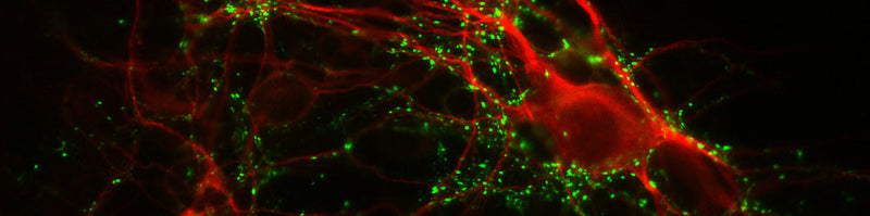 Why Don’t More Researchers Validate Antibodies with WB Before Doing IHC?