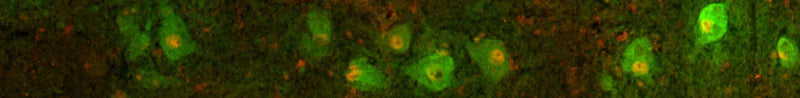 Tyrosine Hydroxylase IF