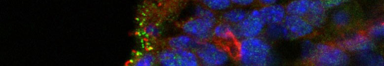 Arl13b Antibody- cat. 75-287