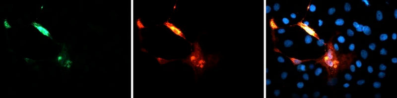Multiplex imaging of epitope and fluorescent tags made easy with chicken antibodies