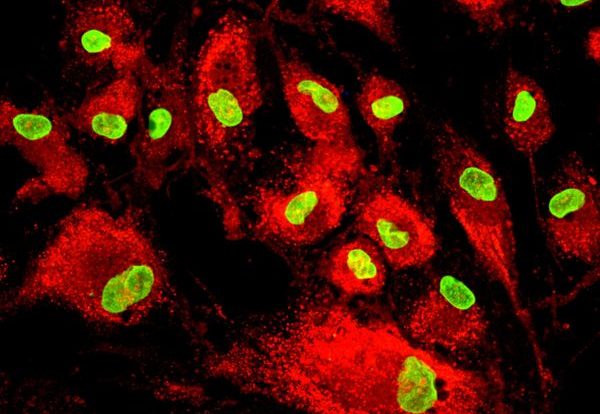 SR FLIVO and SR FLICA cells under fluorescence microscope
