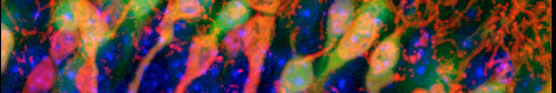 GFP IHC