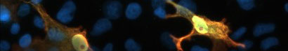 Iba1/AIF1: An excellent marker for microglia/macrophages