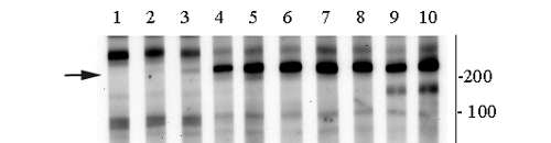 Antibody Variability
