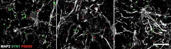 Our Antibodies Are Used in Organoid Research!