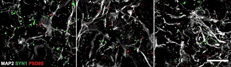 Our Antibodies Are Used in Organoid Research!