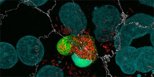 Pyroptosis