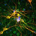 Immunofluorescence of cortical neuron-glial cell culture from E20 rat labeled with Anti- MAP2 (Cat. 1100-MAP2, red, 1:10,000), and Anti-Tau (green). The blue is DAPI staining of nuclear DNA. The anti-MAP2 antibody stains dendrites and perikarya