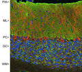 Immunofluorescence of rat cerebellum showing strong synaptic staining of VSNL1 (Cat. : 2145-VSNL1, green) in the molecular layer (ML) and MAP2 (Cat. 1100-MAP2, red, 1:2500). The blue stain is nuclear DNA.