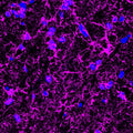 Immunofluorescence of a cross-section from mouse corpus callosum labeling myelin basic protein (Cat. : 1120-MBP, magenta, 1:500) in oligodendrocytes and myelin sheaths. The blue is DAPI counterstaining nuclear DNA. Image kindly provided by Dr.
