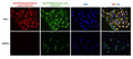 Immunofluorescent staining of HeLa and NIH3T3 cells using PhosphoSolutions anti-Mitochondria (human specific) mouse monoclonal antibody [113-1](Cat No. 1155-MIT) and Aves Labs chicken anti-TOMM20 antibody (Cat No. TOMM20). The cells were fixed with 3% paraformaldehyde, washed with PBS, and blocked/permeabilized with 5% non-fat milk powder in PBST. The anti-Mitochondria antibody (Cat No. 1155-MIT) and the anti-TOMM20 antibody were incubated with the sample at a dilution of 1:800 and 1:200, respectively, at 4°C overnight. After washing with PBST, the cells were stained using goat anti-mouse IgY CF488 secondary antibody (Cat No. 80-1001-488) (green) and goat anti-mouse 594 secondary antibody (red). The staining revealed a complete overlap between the signal from the chicken anti-TOMM20 antibody and the mouse anti-Mitochondria antibody specifically in the cell mitochondria only in HeLa cells. The cells were mounted with Antibodies Incorporated Fluoroshield with DAPI mounting medium (Cat No. AR-6501). DAPI nuclear stain (blue) shows cell nuclei.