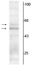 Western blot of rat hippocampal lysate showing specific immunolabeling of the ~50 kDa TR-α1 and the ~58 kDa TR-α2 protein. 