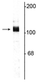 Western blot of rat hippocampal lysate showing specific immunolabeling of the ~115 kDa APP protein. 