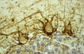 Immunostaining of human cerebellar cortex showing labeling of NF-H (Cat. 1450-NFH, DAB, 1:500) in basket cell axons surrounding the large Purkinje neurons. Cerebellar granule cell layer is at the bottom of