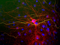 Immunostaining of mixed cultured rat neurons and glia stained with anti-NFL antibody (Cat. 1453-NFL, red, 1:5000). The NF-L protein is assembled into neurofilaments which are found throughout the axons, dendrites, and perikarya as shown