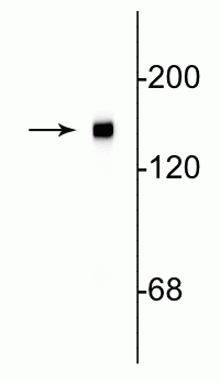 Anti-Neurofilament NF-M Antibody (3H11) | 1454-NFM