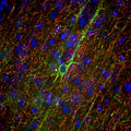 Immunofluorescence of a section of adult rat frontal cortex labeled with anti-Neurofilament-M (Cat. 1454-NFM, 1:5000, red) and anti-Neurofilament-H (Cat. 1451-NFH, 1:5000, green). The anti-NFM specifically labels neuron cell bodies and dendrites of pyramidal neurons, while the anti-NFH labels the network