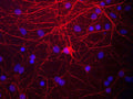 Immunostaining of cultured rat neurons and glia stained with anti-NFM antibody (Cat. 1455-NFM, red, 1:1000) and DNA is stained blue.