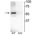 Western blot of mouse habenula lysate showing specific immunolabeling of the ~52 kDa nAChRβ4 protein.
