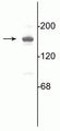 Western blot of 10 µg of rat hippocampal lysate showing specific immunolabeling of the ~180 kDa NR2A subunit of the NMDA receptor.