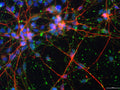 Immunofluorescence of healthy iPSC-derived neurons labeled with Anti-NMDA Receptor, NR2B subunit (Cat. 1498-NR2B, green, 1:100) and Anti-TuJ1 (red). The blue is Hoechst staining of nuclear DNA. Image kindly provided by Dr. Allison Ebert,