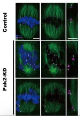 Control and Pak2-KD metaphase mouse oocytes were labeled with CREST antibody for kinetochores (cat. 15-234, 1:300; purple), anti-tubulin antibody for microtubules (green), and Hoechst 33342 for chromosomes (blue). Image from publication CC-BY-4.0. PMID:36813765