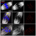 Representative images of the morphology of K-M attachments in MI oocytes from both control and BBP-exposed group. α-tubulin (gray); CREST (Cat. 15-234, 1:200; red); DNA (blue). Image from publication CC-BY-4.0. PMID:36756972