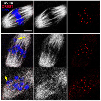 Representative images of the morphology of K-M attachments in MI oocytes from both control and BBP-exposed group. α-tubulin (gray); CREST (cat. 15-234, 1:200; red); DNA (blue). Image from publication CC-BY-4.0. PMID:36756972