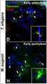 Localization of telomeric sequences in Thylamys elegans and Macropus eugenii. Spread spermatocytes were labeled with antibodies against SYCP3 (blue), centromeric proteins (Cat. 15-234, 1:50; red) and telomeric sequences (green) in (D) and (H). Image from publication CC-BY-4.0. PMID:37181752