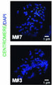 Costaining of chromosomes (DAPI, blue) and centromeres (Cat. 15-234, 1:250; green) in representative nuclei of metaphase short-term cultures, established from Nf2KO-Setd2KO-Trp53KO-4q9p21 tumor-bearing mice. Image from publication CC-BY-4.0. Cat. 15-234, 1:50) in prometaphase and metaphase cells. Image from publication CC-BY-4.0. PMID:37263996