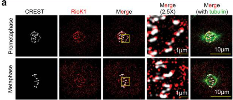 Representative immunofluorescence images of RioK1 at kinetochores (CREST) (cat. 15-234, 1:50) in prometaphase and metaphase cells. Image from publication CC-BY-4.0. PMID:37263996