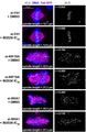 RPE1 53BP1‐V5 cells were either left untreated (async = asynchronous) or synchronized in prometaphase in medium containing nocodazole, fixed immediately (M = mitosis) or after 2, 4, or 6 h and co‐stained with V5 and CREST (Cat. 15-234, 1:500). Image from publication CC-BY-4.0. PMID:37888778
