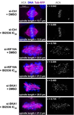 RPE-1 cells expressing H2B-GFP and α-Tub-mRFP (magenta) were treated as indicated, fixed and stained for centromeres (ACA) (cat. 15-234, 1:400; white) and DNA (DAPI, blue). BI2536 was added at the IC30 concentration (5 nM). Representative cells are shown, with their measured spindle lengths and centromere dispersion ratios (r). Image from publication CC-BY-4.0. PMID:37639469