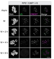 C3a-peptide treatment does not induce chromosome aneuploidy of mouse oocytes. Representative images of MII oocyte immunofluorescence stained with DAPI (blue) and anti-CREST (Cat. 15-234, 1:500; magenta) antibodies showing euploidy and aneuploidy in the oocytes, respectively (left). Image from publication CC-BY-4.0. PMID:38066646
