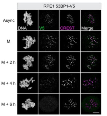 RPE1 53BP1‐V5 cells were either left untreated (async = asynchronous) or synchronized in prometaphase in medium containing nocodazole, fixed immediately (M = mitosis) or after 2, 4, or 6 h and co‐stained with V5 and CREST (cat. 15-234, 1:500). Image from publication CC-BY-4.0. PMID:37888778