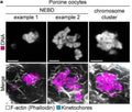 Immunofluorescence images of porcine oocytes shortly after NEBD (z-projections, example 1: 14 sections, example 2: 11 sections every 0.19 µm) and after chromosome cluster formation (z-projection, 14 sections every 0.19 µm). F-actin (phalloidin; white); kinetochores (ACA) (Cat. 15-234, 1:250; cyan); DNA (Hoechst, magenta,). Image from publication CC-BY-4.0. PMID:36732633
