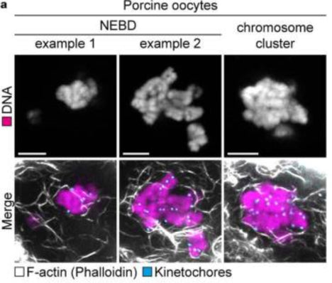 Immunofluorescence images of porcine oocytes shortly after NEBD (z-projections, example 1: 14 sections, example 2: 11 sections every 0.19 µm) and after chromosome cluster formation (z-projection, 14 sections every 0.19 µm). F-actin (phalloidin; white); kinetochores (ACA)(cat. 15-234, 1:250; cyan); DNA (Hoechst, magenta,). Image from publication CC-BY-4.0. PMID:36732633