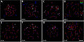 Representative images of chromosome spreading (Cat. 15-234, 1:200) of euploid and aneuploid mouse oocytes. Image from publication CC-BY-4.0. PMID:37386516