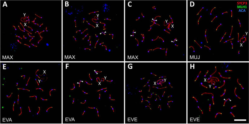 Pachytene and pachytene-like spermatocytes of A. maximowiczii, MAX (A–C), A. evoronensis “Argi” × A. evoronensis “Evoron”, EVA × EVE (D–F), A. mujanensis × A. maximowiczii, MUJ × MAX (G–I), A. evoronensis “Argi” × A. mujanensis, EVA × MUJ (J–L), and A. evoronensis “Argi” × A. maximowiczii, EVA × MAX (M–O) after immunolocalization of SYCP3, SYCP1, MLH1, γH2A.X, and centromeric proteins (ACA, cat. 15-234, 1:100). Arrowheads show asynapsed SC regions of the autosomes. CC-BY-4.0. PMID:37263996